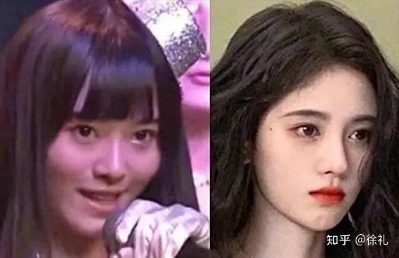 整容最成功的女明星是谁？ - 知乎