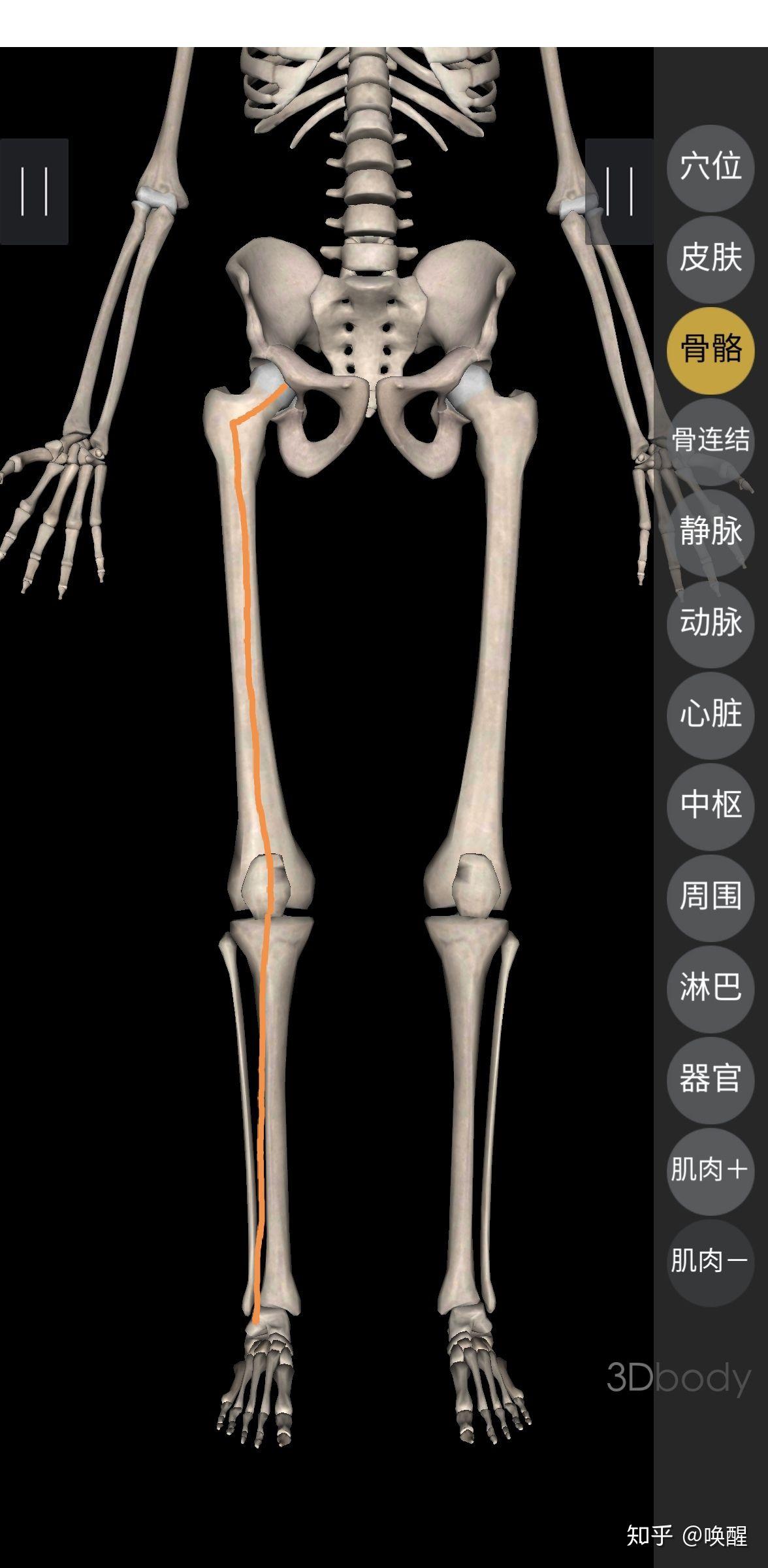 我这腿怎么办?骨头是长歪了吗? - 知乎