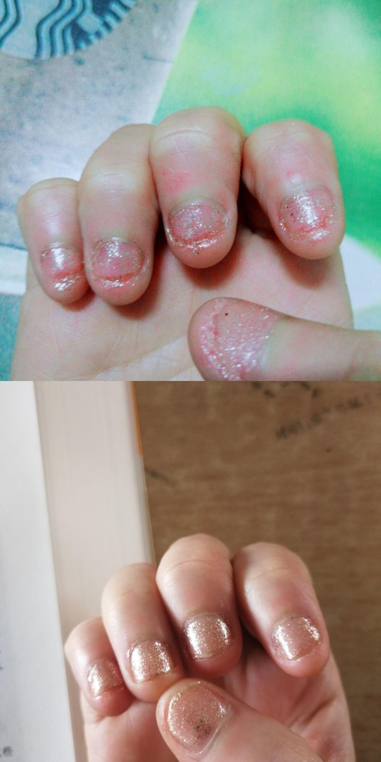 咬指甲怎么戒除