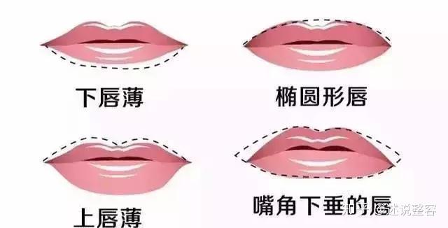 进来看看!玻尿酸丰唇的注射方法及常见问题