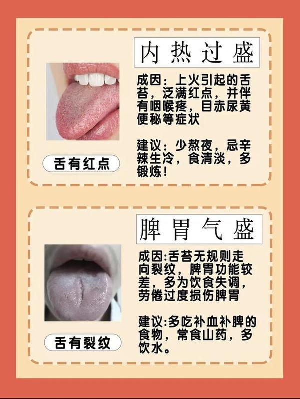 6种常见舌象,对照一下自己 - 知乎