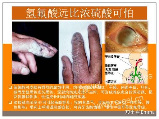 氢氟酸远比硫酸毒:上过高中的应该都知道氢氟酸有多厉害:高中化学学过