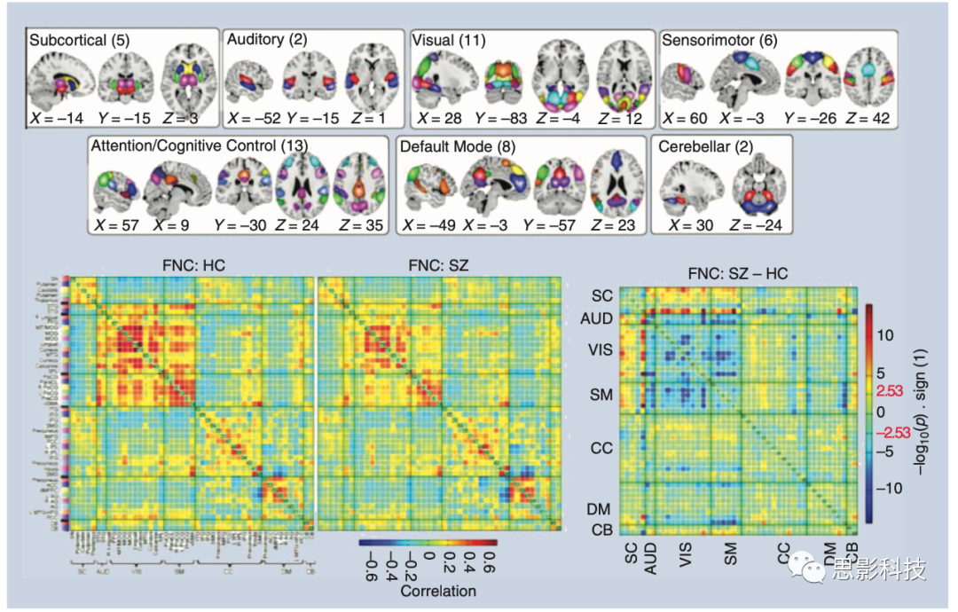 IEEE Signal Processing Magazine：fMRI数据的时变脑连接 - 知乎