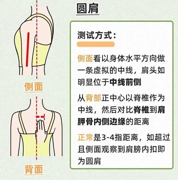 肱骨前移怎么办？ - 知乎
