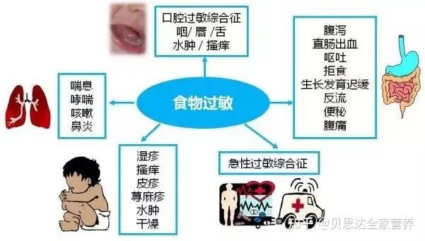 世界过敏性疾病日 | 过敏是因为免疫力太强了吗?带你看清过敏的真相 - 知乎