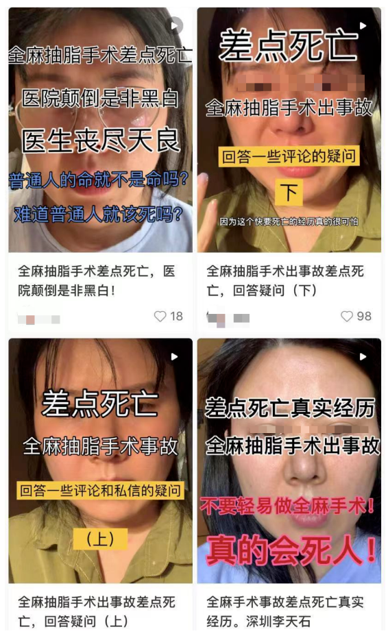 33岁网红抽脂感染身亡,生前照片惨不忍睹:痛到自己打120,两次全身开刀