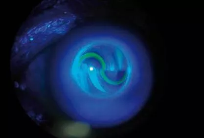 眼科怎么测眼压 v2-17255e188489489ab66512d7df293b61_1440w.jpg?source=172ae18b