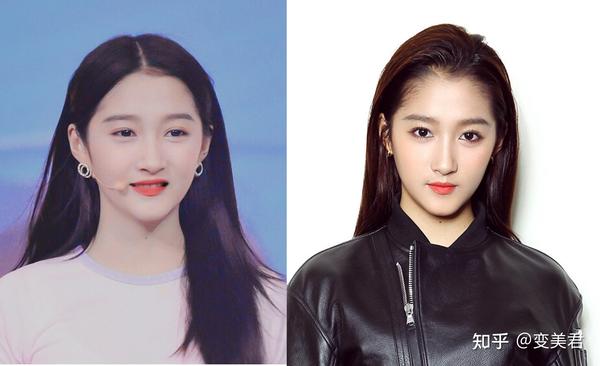 网红们开始另辟蹊径给耳朵做整形了 知乎