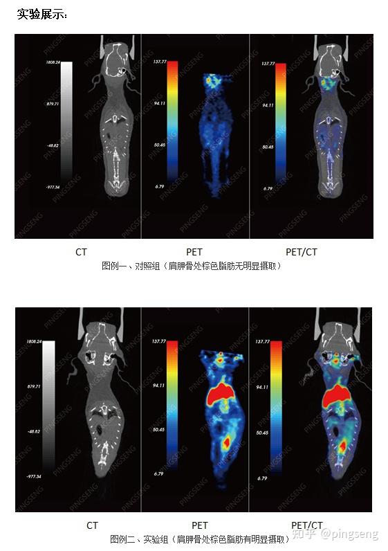 小动物petct在棕色脂肪方面的应用