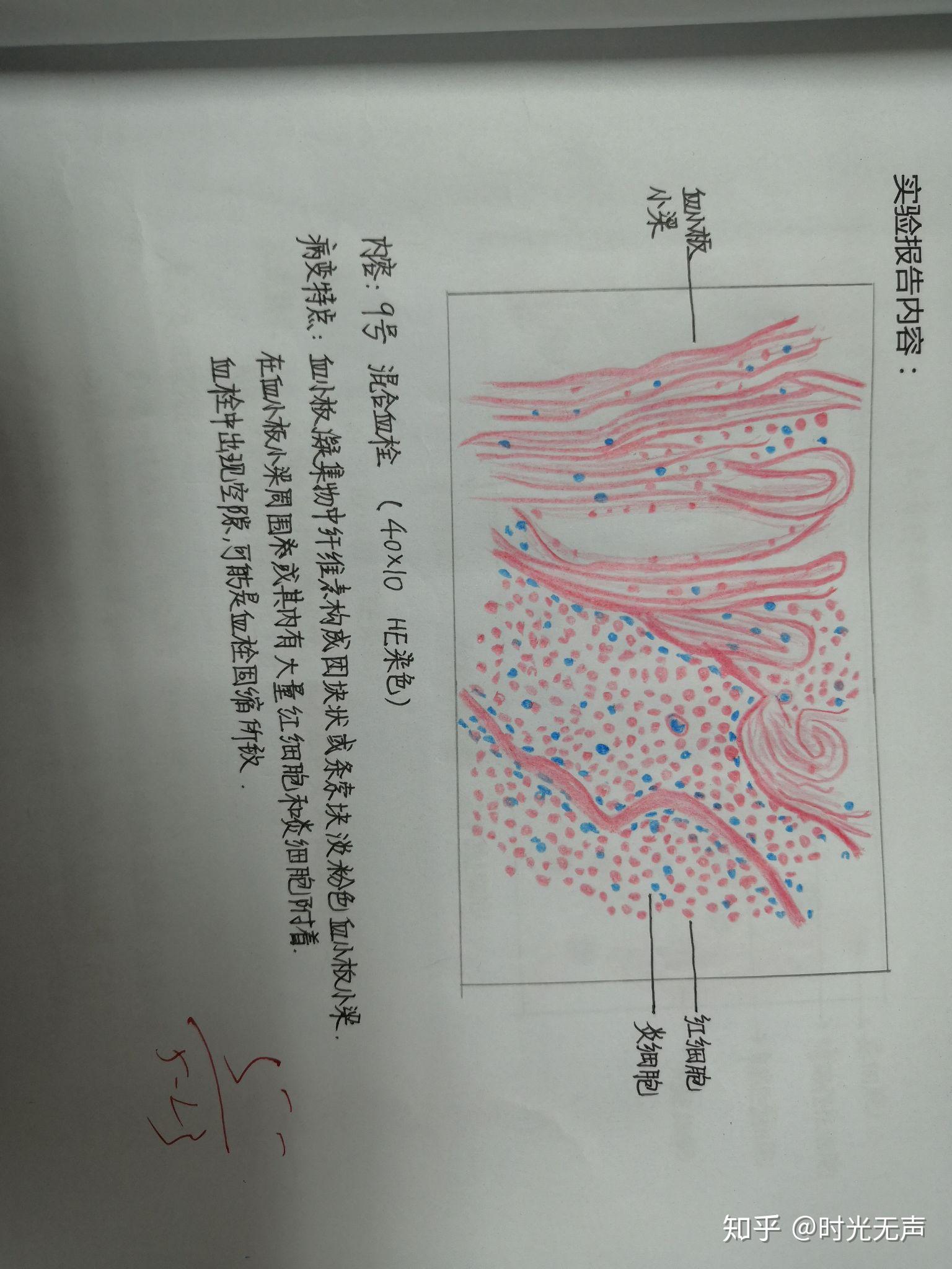 绒癌手绘图图片