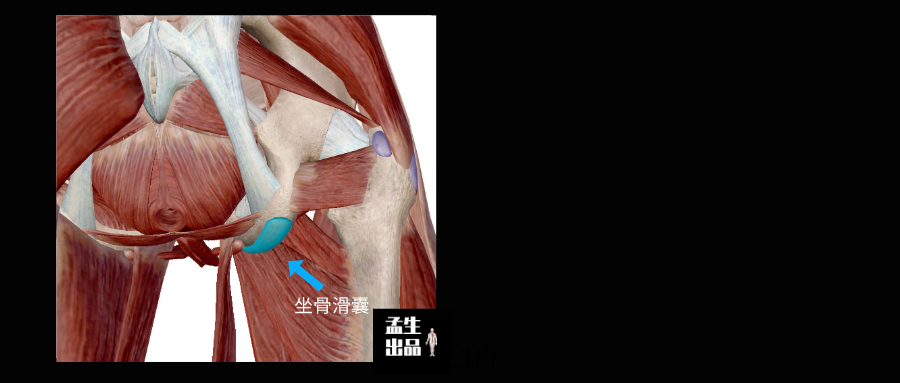 薄弱的臀部肌群或者急性的摔伤导致坐骨结节滑囊出现损伤,滑囊