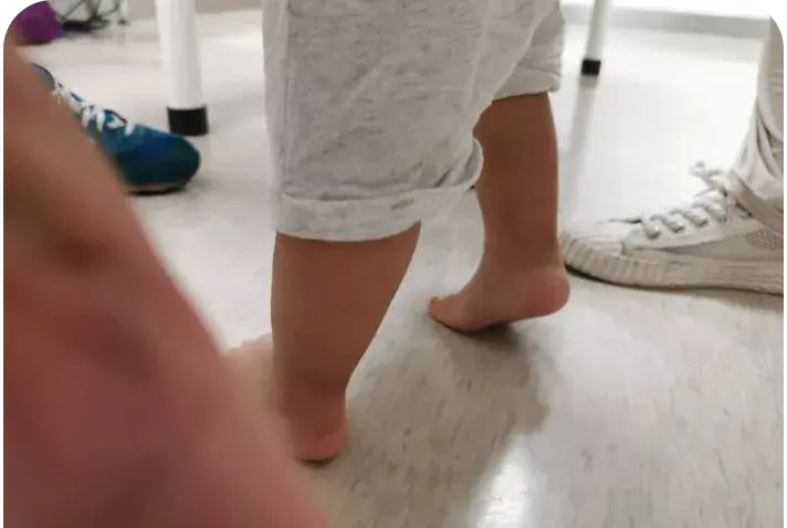 需要矫正吗? - 知乎