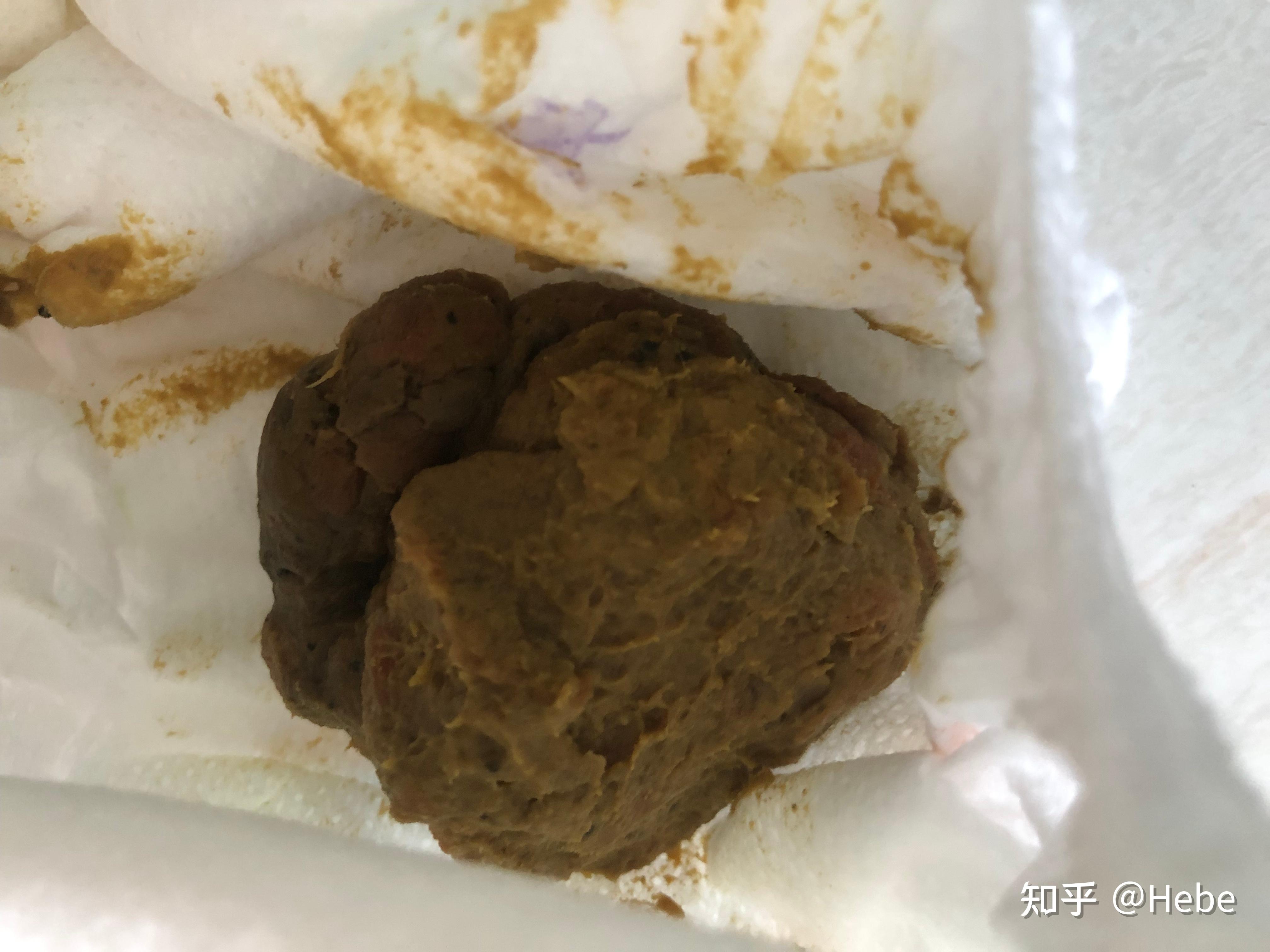 1岁女宝羊屎蛋便便便秘调理中持续更新