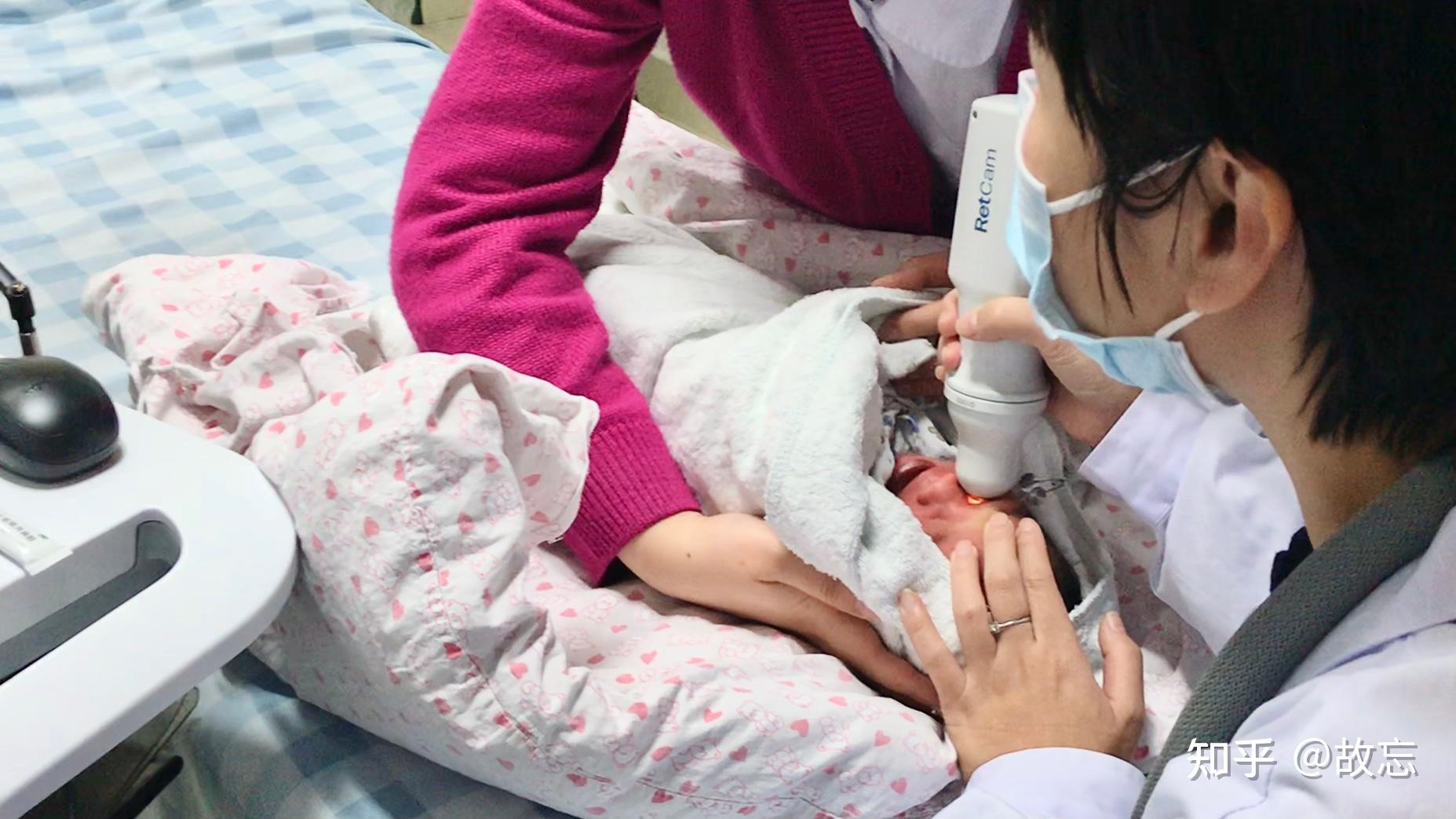 全球领先新生儿眼底检查设备retcam