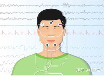 多导睡眠图psg 预防打鼾要提早 知乎