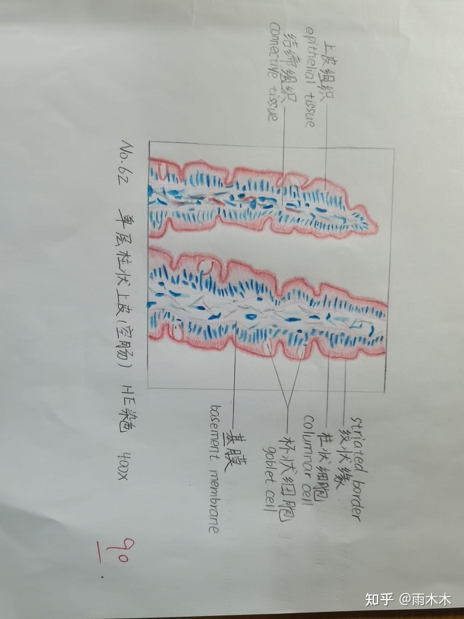 内基小体手绘图图片