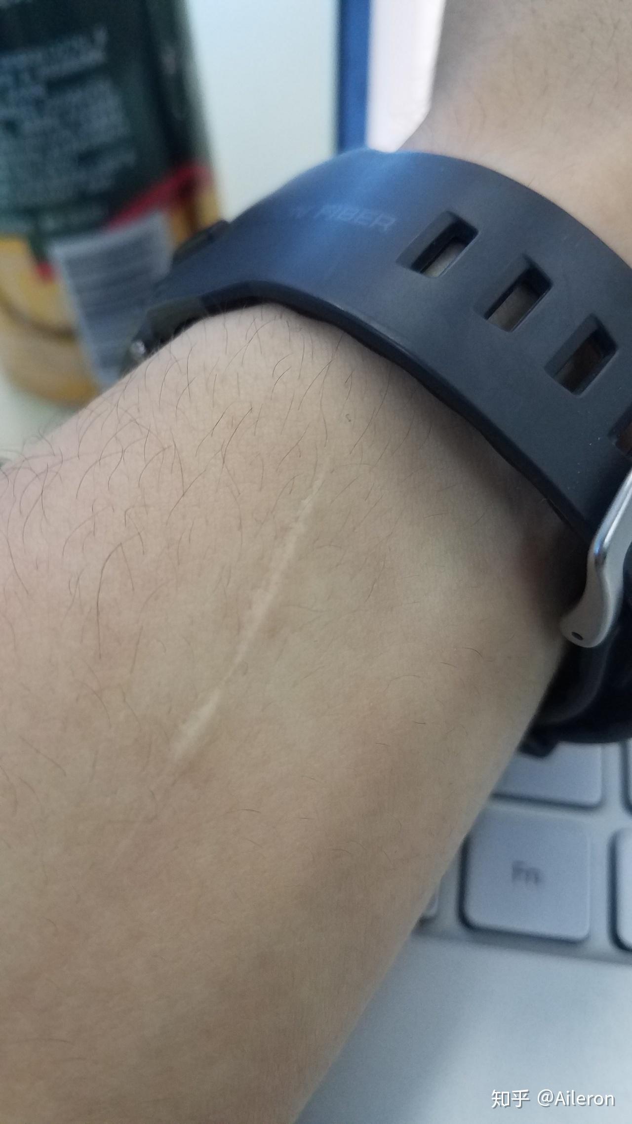 往胳膊上划一刀是什么感觉