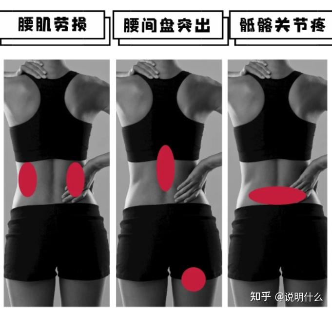 有什么方法可以缓解颈椎疼腰疼？ - 知乎