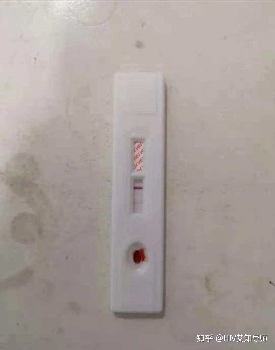 警惕!检测后无套被传染hiv