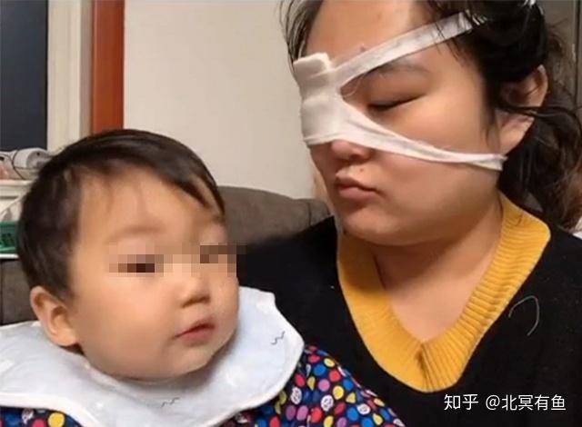 一位"独眼"宝妈缠着纱布,讲述被娃伤害的经历