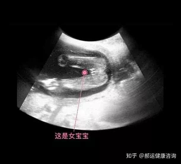 玩耍脐带,开始有了妈妈能够感受到的胎动,胎儿生殖器官的发育开始可见