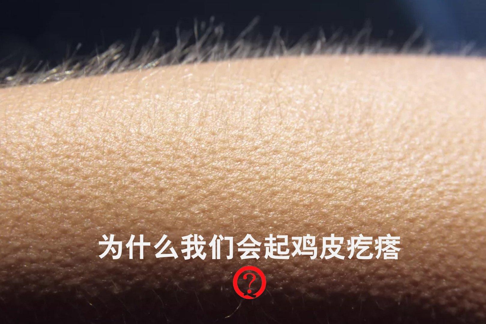 为什么我们会起鸡皮疙瘩? - 知乎