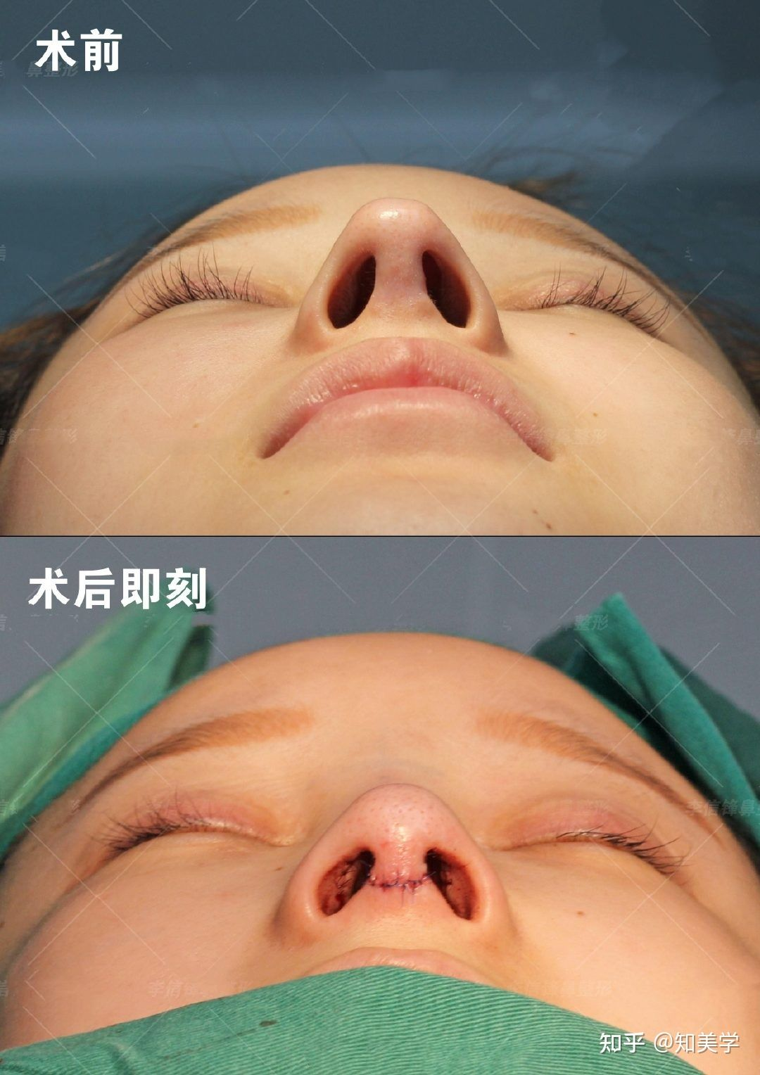 新人晒侧面,高手晒鼻尖,王者晒鼻孔