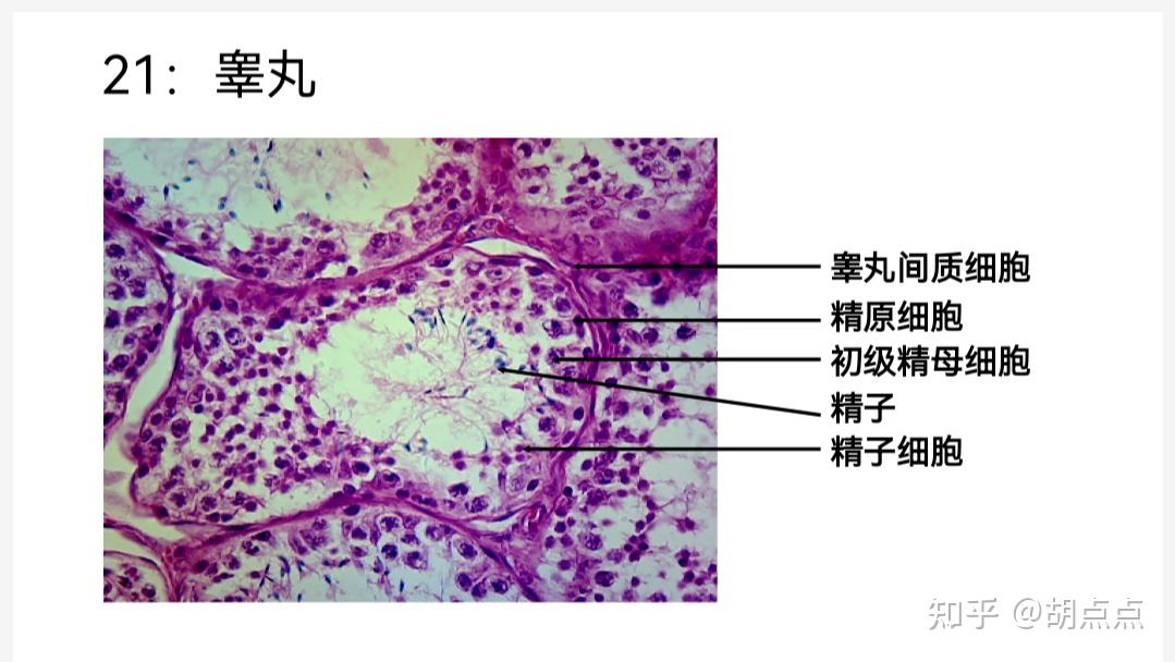 睾丸组织切片图解图片