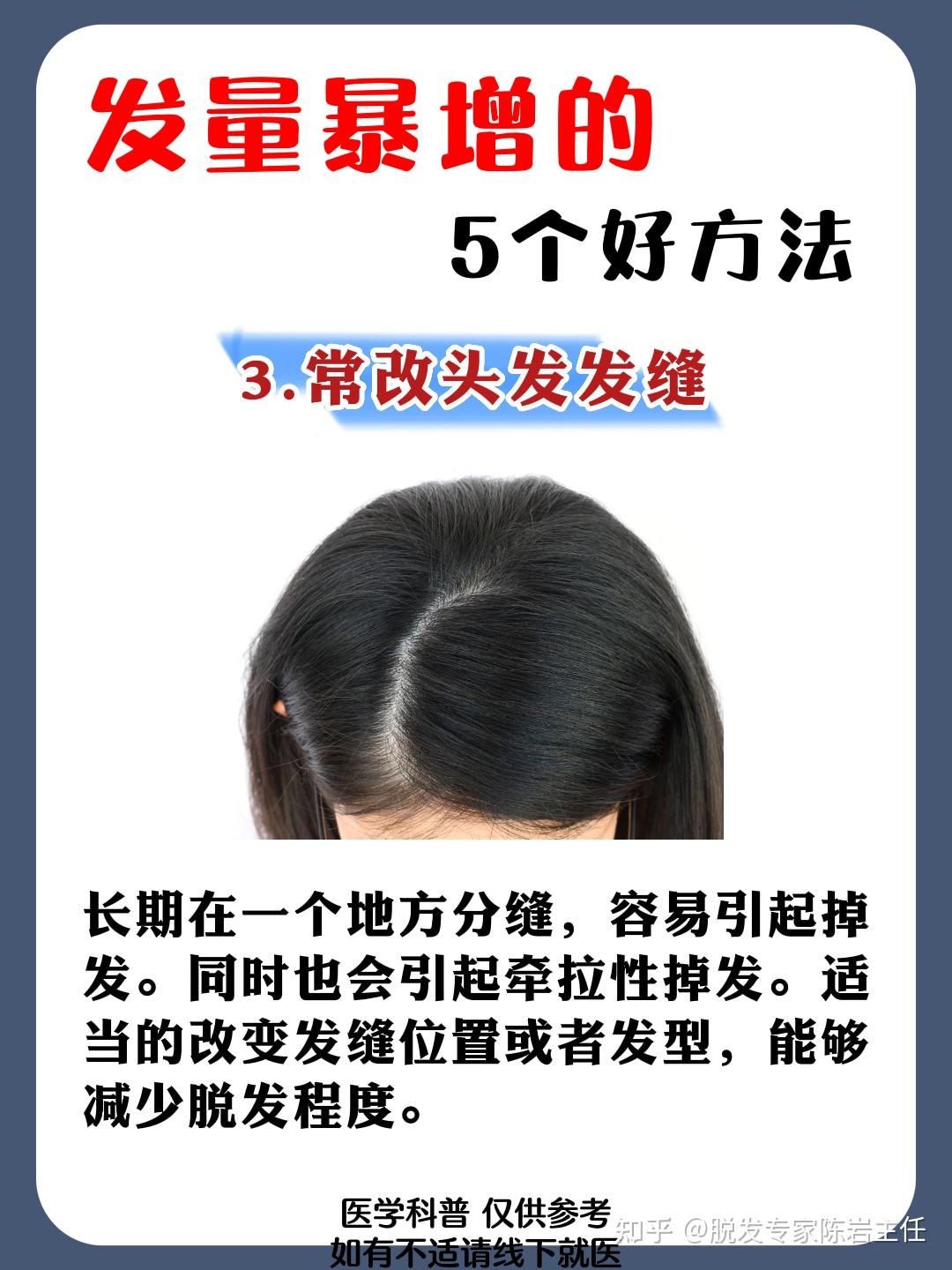 发量暴增的5个好方法! - 知乎
