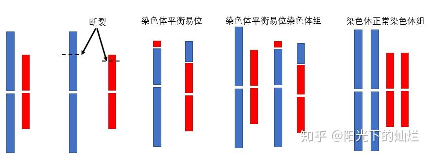 染色体易位:从基因融合到肿瘤发生 - 知乎