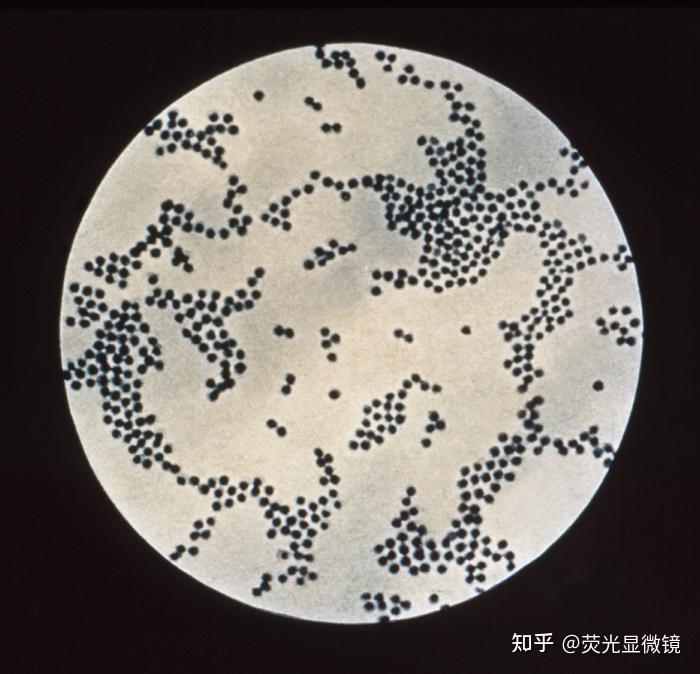 显微镜下的葡萄球菌 - 知乎