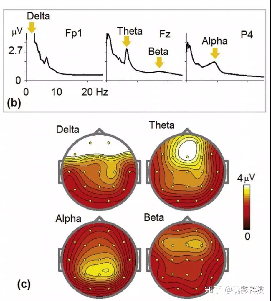 浅谈脑电的theta频段振荡