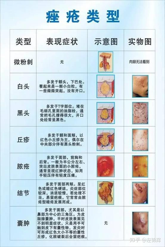 两者的活性成分,在功能上有一定的重叠,一起在同一个部位使用,很容易