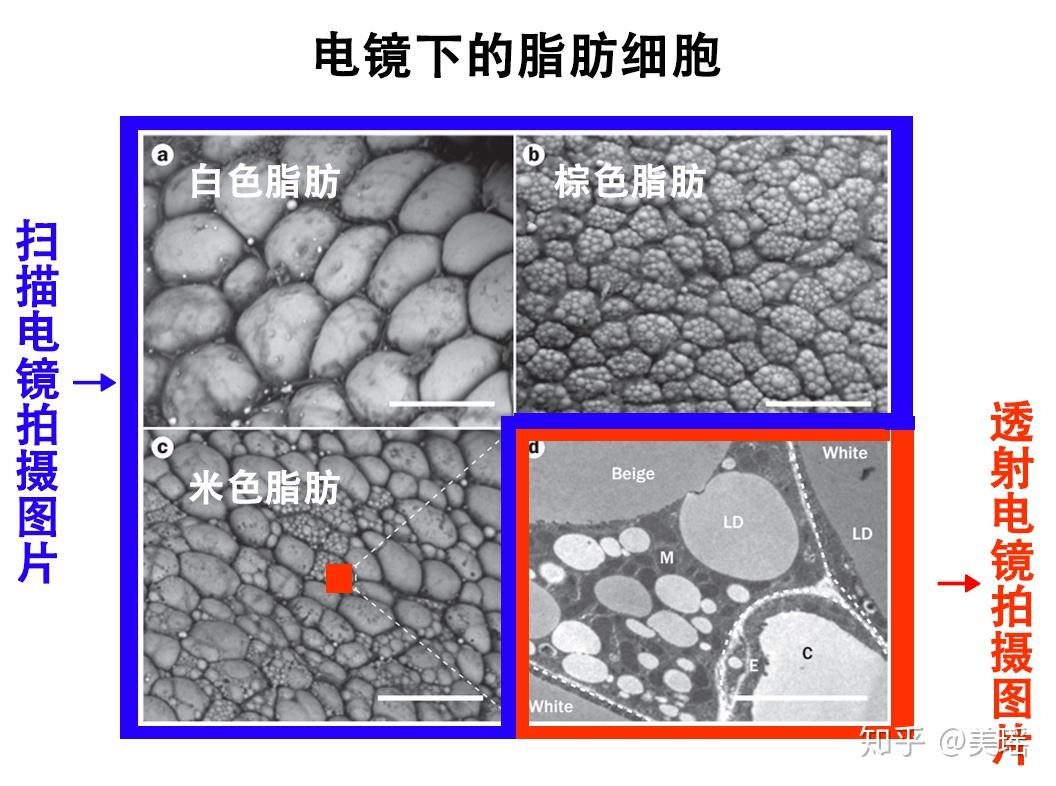 什么是脂肪组织有哪些分类