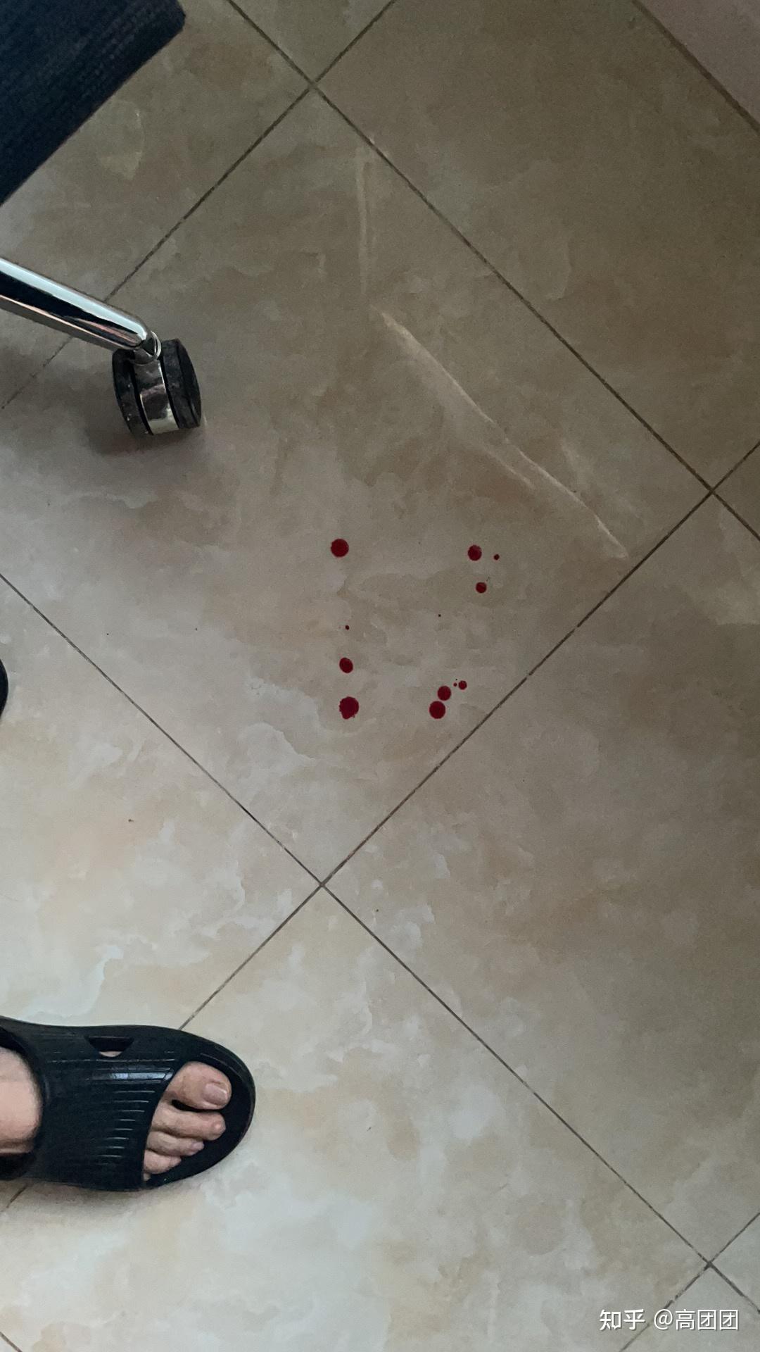 白地板上的血真实图片图片