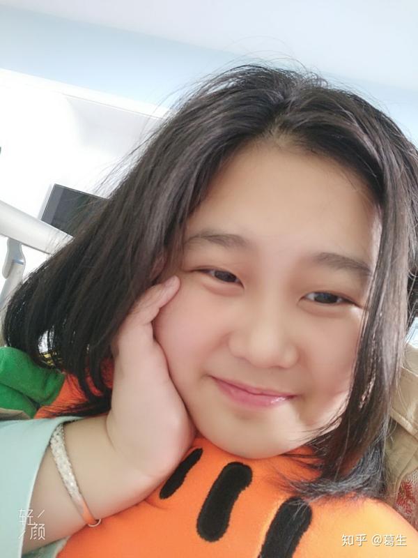 娃娃脸(童颜)是一种怎样的体验?