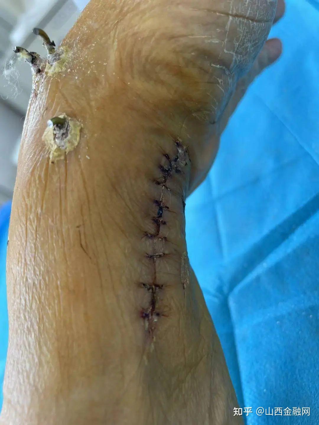 临汾女子被电动车刮倒在地手腕骨折肇事者不闻不问