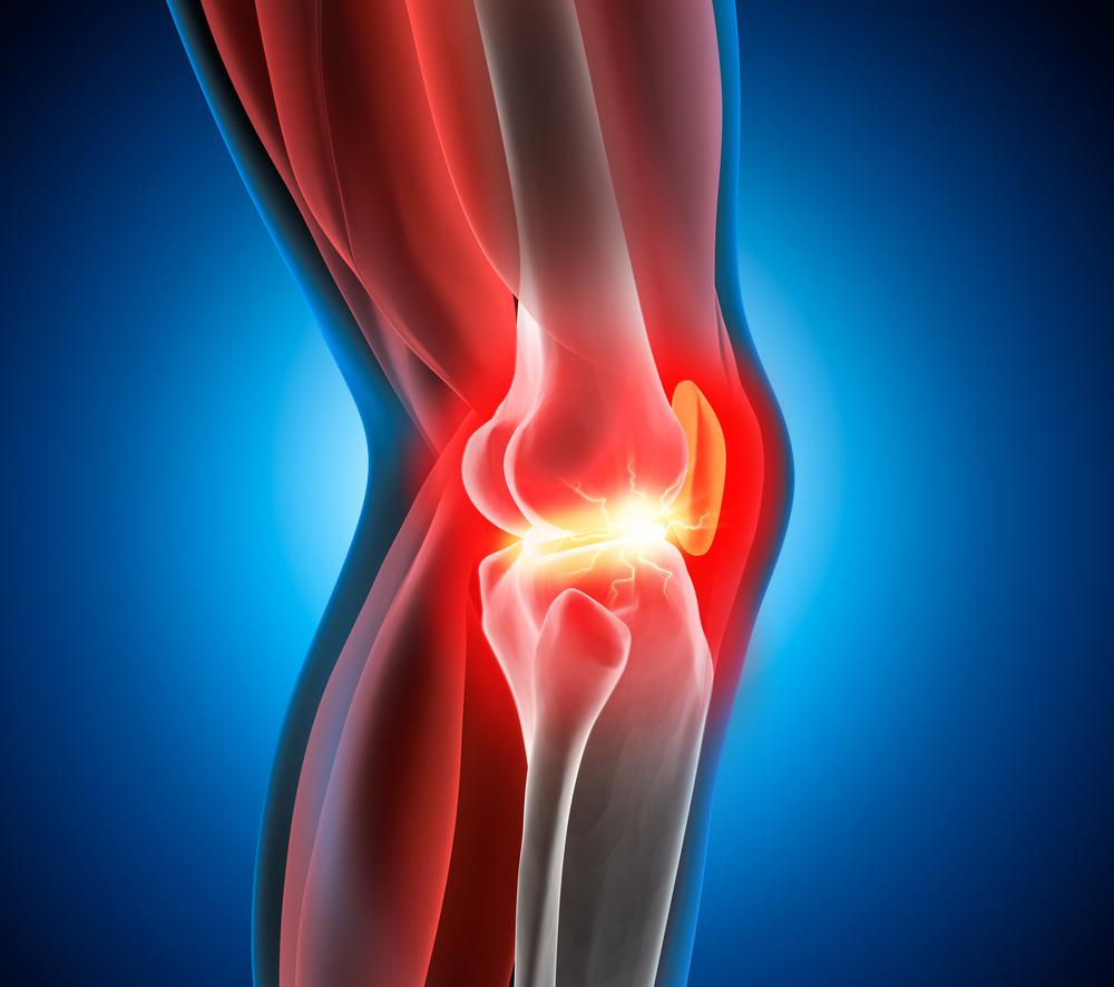 膝盖疼当出现这8种情况小心是关节炎