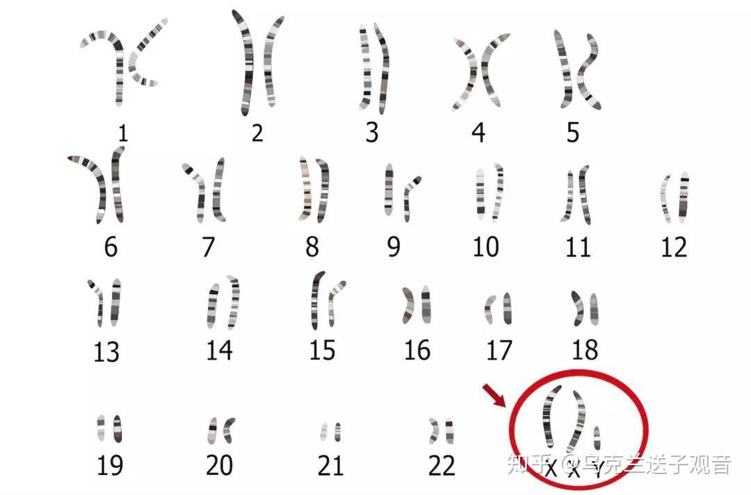 关于人类染色体核型报告解读及相关案例简述lrc