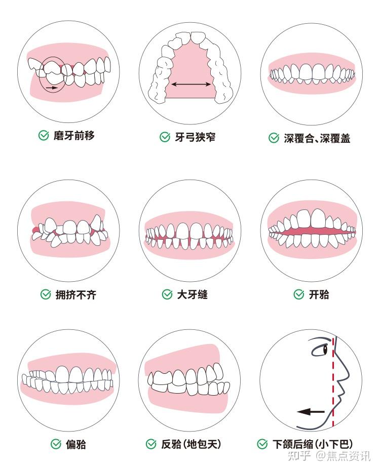 颌骨在哪里发育不良图片