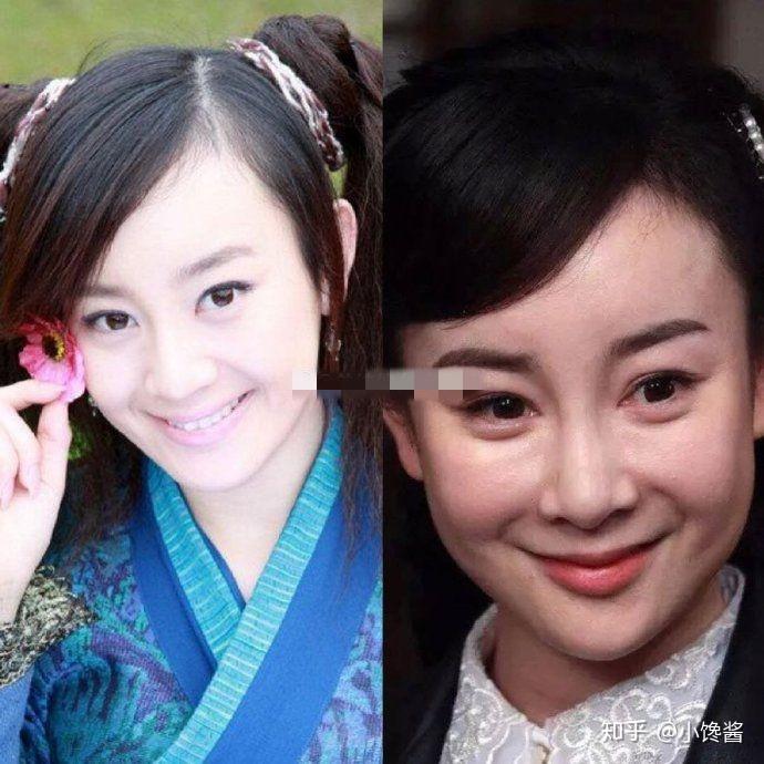 张檬改善一个部位就够美商不足盲目整容变丑她全摊上了