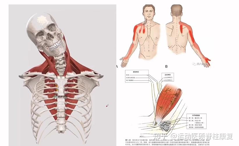 颈突神经卡压疼痛部位分析