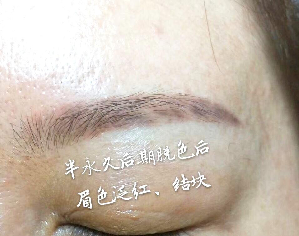 纹眉者说 误区之一 红眉毛蓝眉毛是纹眉色料造成的吗 知乎 纹眉者说 误区之一 红眉毛蓝眉毛是纹眉色料造成的吗 知乎