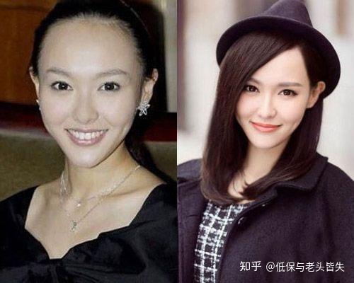 明星鬓角植发(明星鬓角头发怎么弄的)