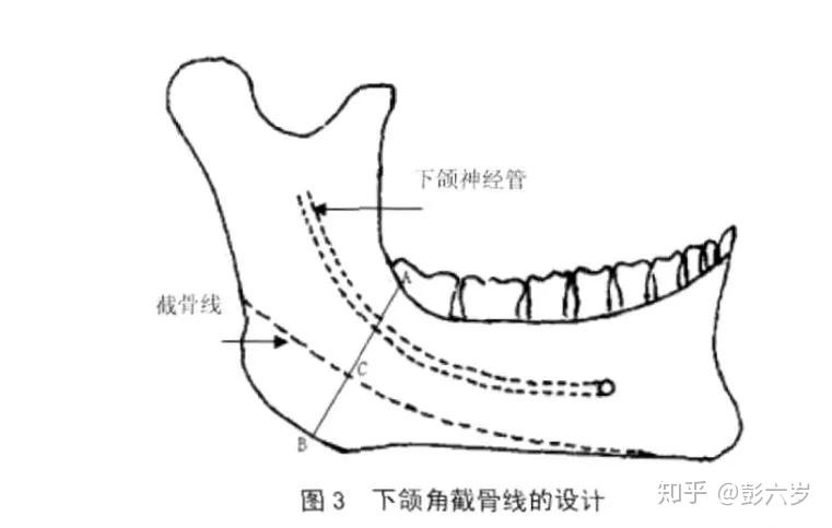 下颌升支 解剖图图片