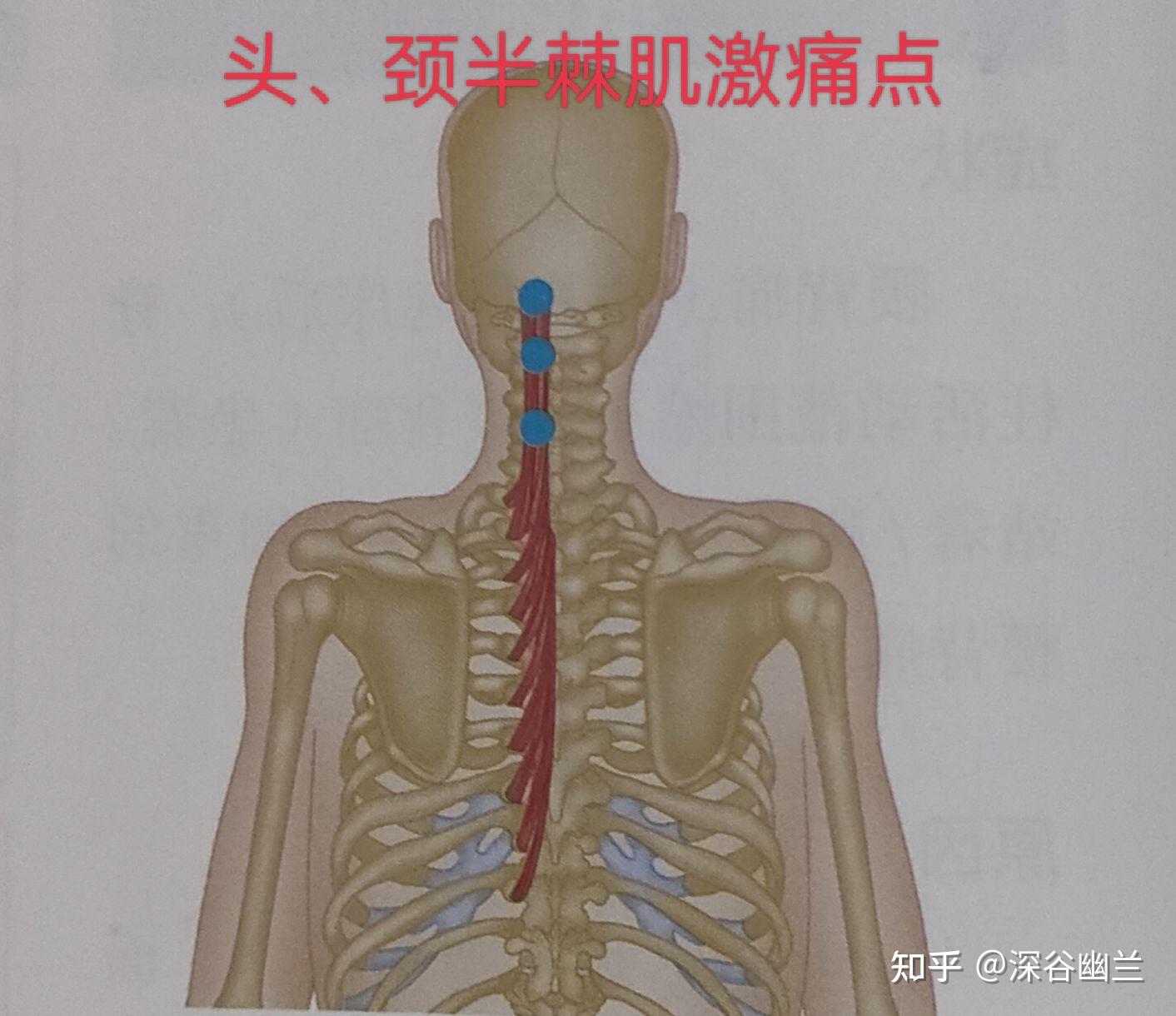 头半棘肌肌肉因紧张产生激痛点在棘突旁的枕部和枕下,其牵涉痛位于
