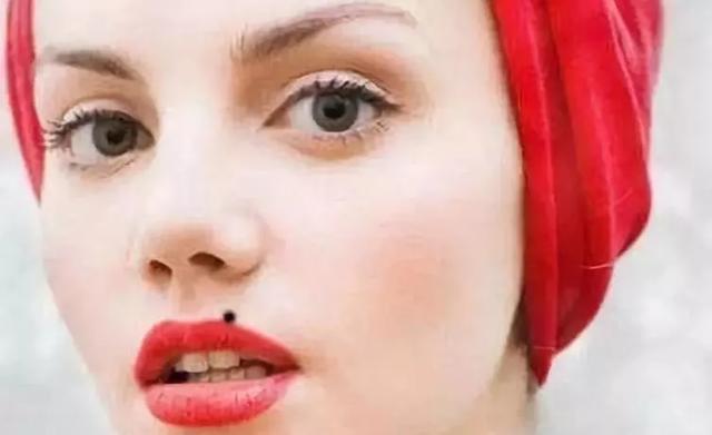 嘴上痣不同寓意疣清达