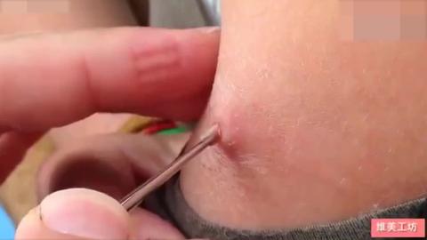 (转自b站,侵删) 流量党自觉看下方介绍. 人肤蝇,肤蝇的一种.