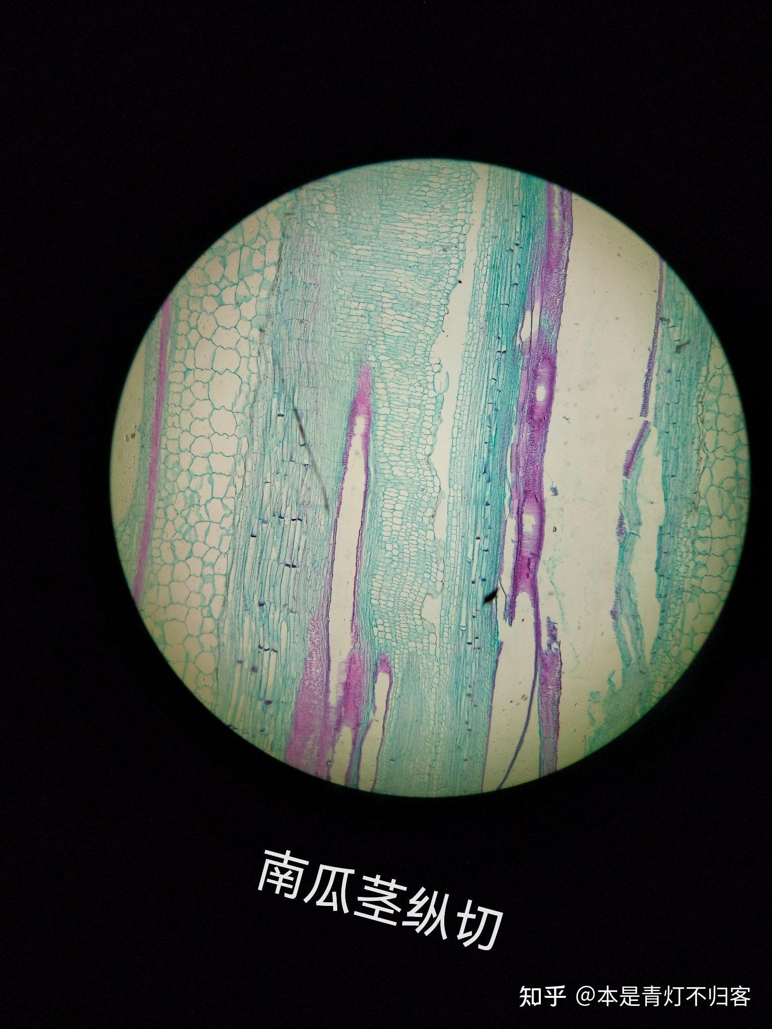 南瓜茎纵切结构图筛管图片