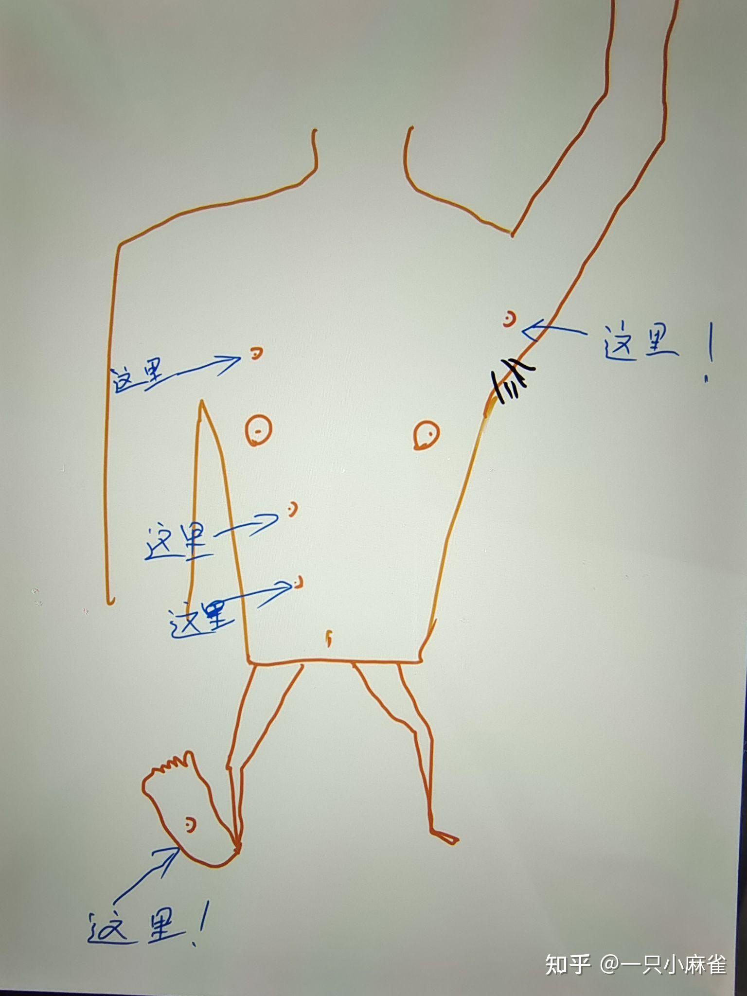 其实不只是副乳,多出来的咪咪也可能长在↓↓